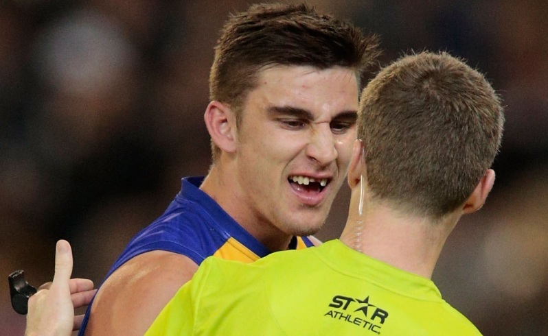 West Coast Eagles Elliot Yeo shows the umpire the gap in his teeth after his collision with Collingwoods Jarrod Witts during the 2014 AFL Round 10 match between the Collingwood Magpies and the West Coast Eagles at the MCG, Melbourne on May 24, 2014. (Photo: Greg Ford/AFL Media)